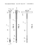 PERCUTANEOUS ARTHRODESIS METHOD AND SYSTEM diagram and image