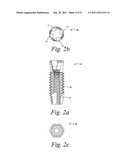 TITANIUM NANO-SCALE ETCHING ON AN IMPLANT SURFACE diagram and image