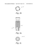 TITANIUM NANO-SCALE ETCHING ON AN IMPLANT SURFACE diagram and image