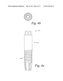 TITANIUM NANO-SCALE ETCHING ON AN IMPLANT SURFACE diagram and image