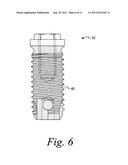 TITANIUM NANO-SCALE ETCHING ON AN IMPLANT SURFACE diagram and image