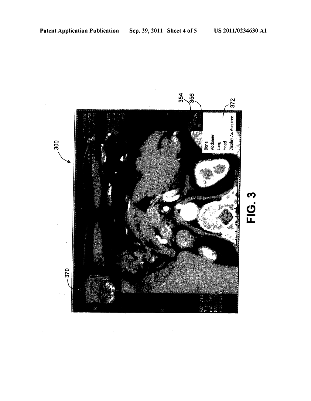 Active Overlay System and Method for Accessing and Manipulating Imaging     Displays - diagram, schematic, and image 05