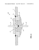 Electrical Feedthrough of a Capacitor for Medical Implants and Method for     the Production and Use Thereof diagram and image