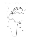 HEARING AID DEVICE WITH A VOLUME CONTROL diagram and image