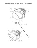 HEARING AID DEVICE WITH A VOLUME CONTROL diagram and image