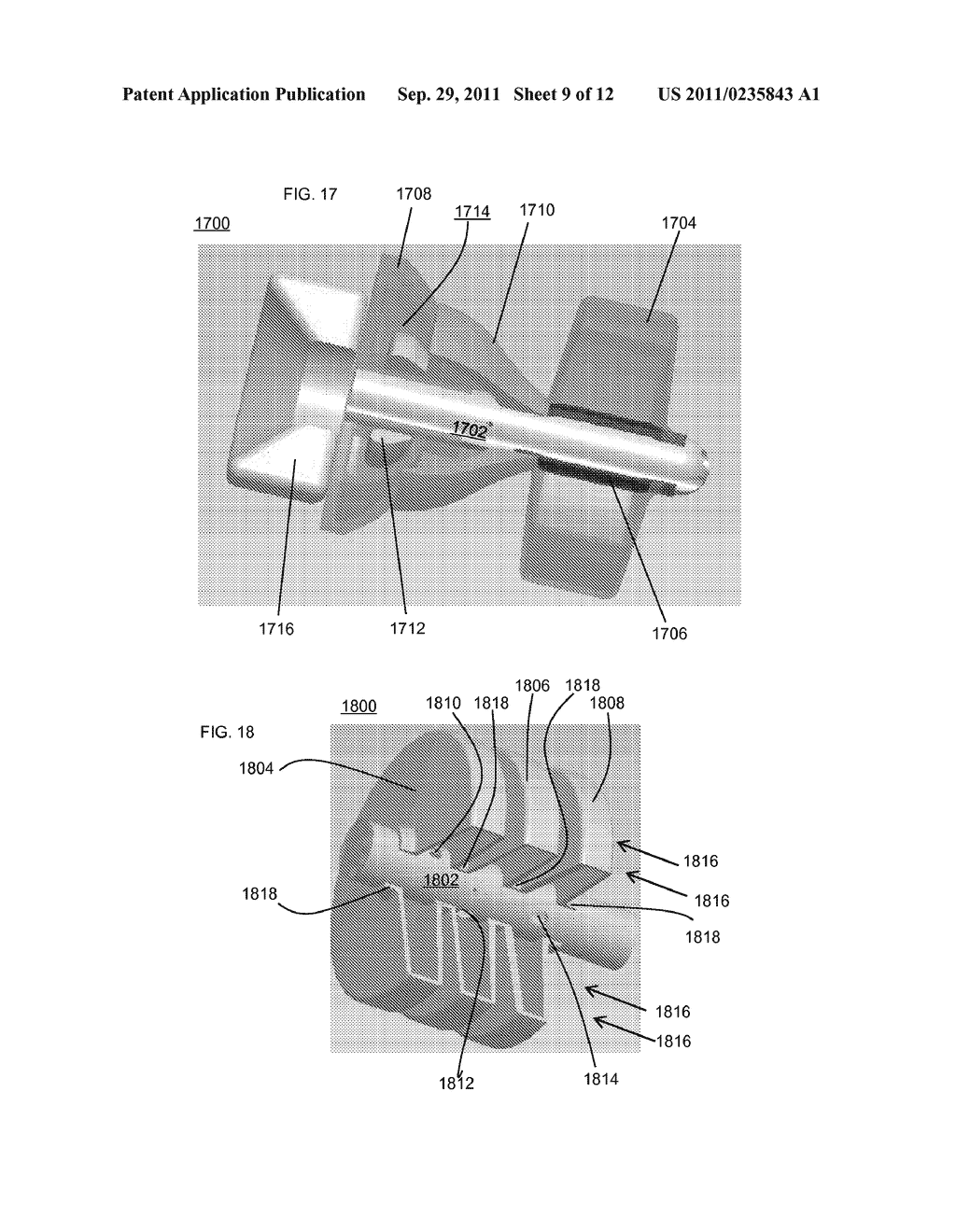 METHOD AND DEVICE FOR ACOUSTIC SEALING AND OCCLUSION EFFECT MITIGATION - diagram, schematic, and image 10