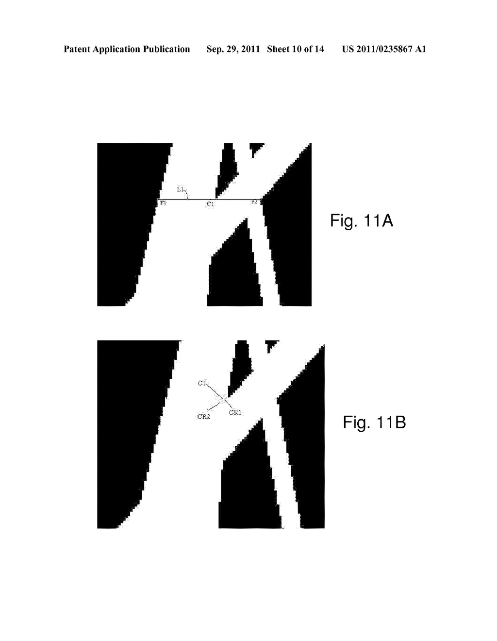 METHOD AND SYSTEM OF DETERMINING THE FIBER DIAMETER DISTRIBUTION OF A     FIBROUS MEDIA - diagram, schematic, and image 11