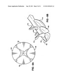 EXPANDABLE IMPELLER PUMP diagram and image