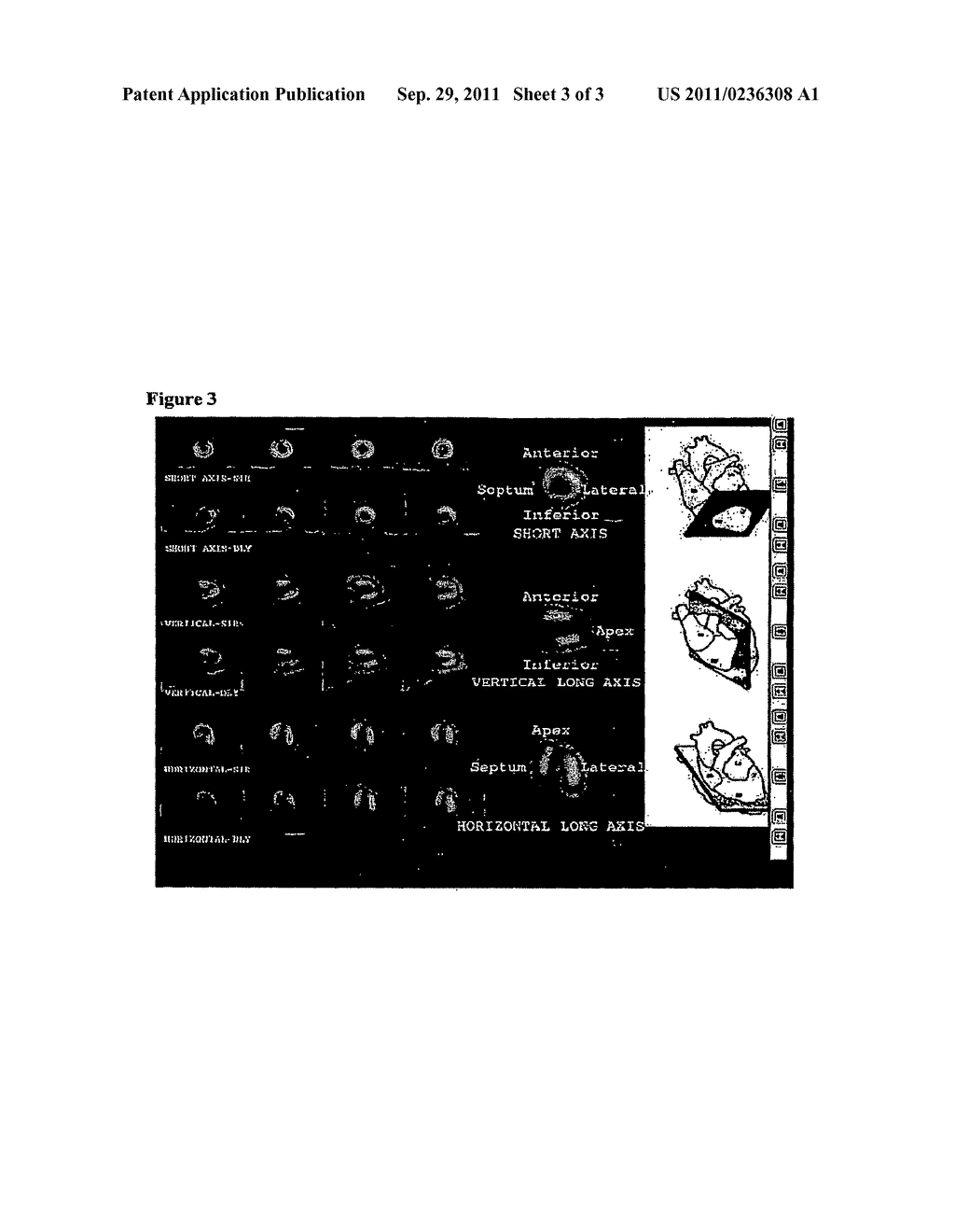 Aryl Bidentate Isonitriles and Their Uses - diagram, schematic, and image 04