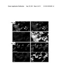 INHIBITION OF INTER-ALPHA TRYPSIN INHIBITOR FOR THE TREATMENT OF AIRWAY     DISEASE diagram and image