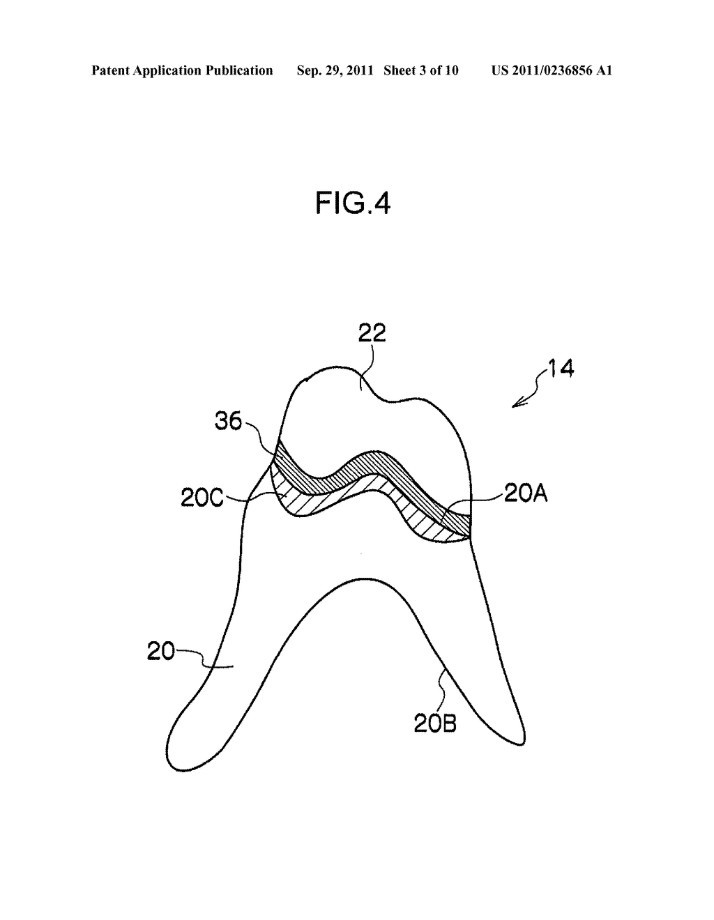 REMOVABLE DENTURE AND METHOD OF PRODUCING THE SAME - diagram, schematic, and image 04