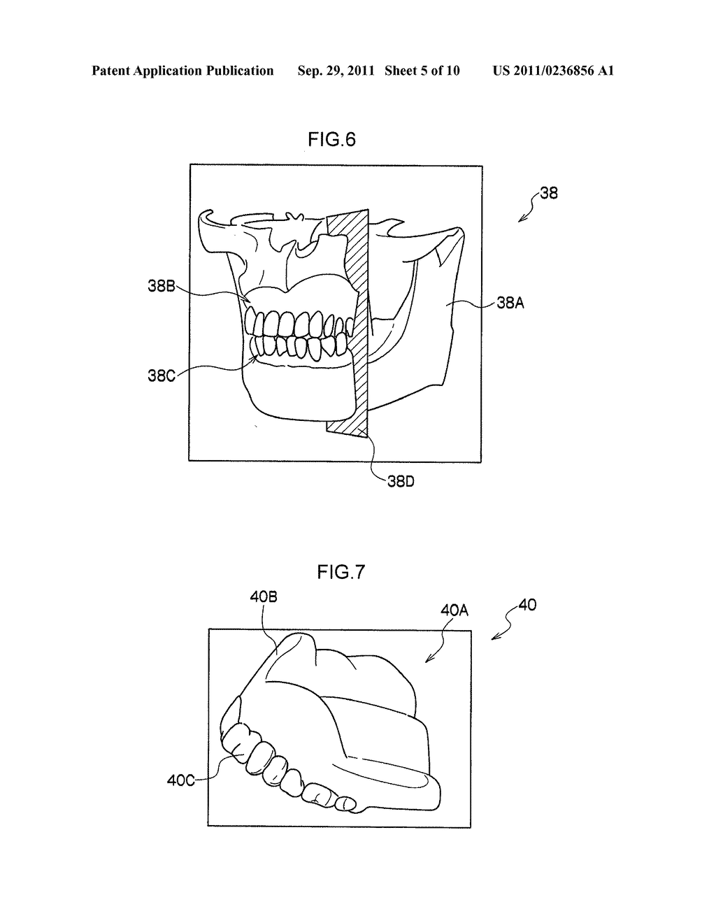 REMOVABLE DENTURE AND METHOD OF PRODUCING THE SAME - diagram, schematic, and image 06