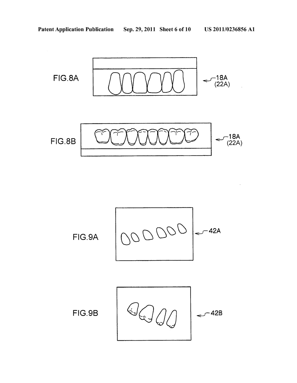 REMOVABLE DENTURE AND METHOD OF PRODUCING THE SAME - diagram, schematic, and image 07