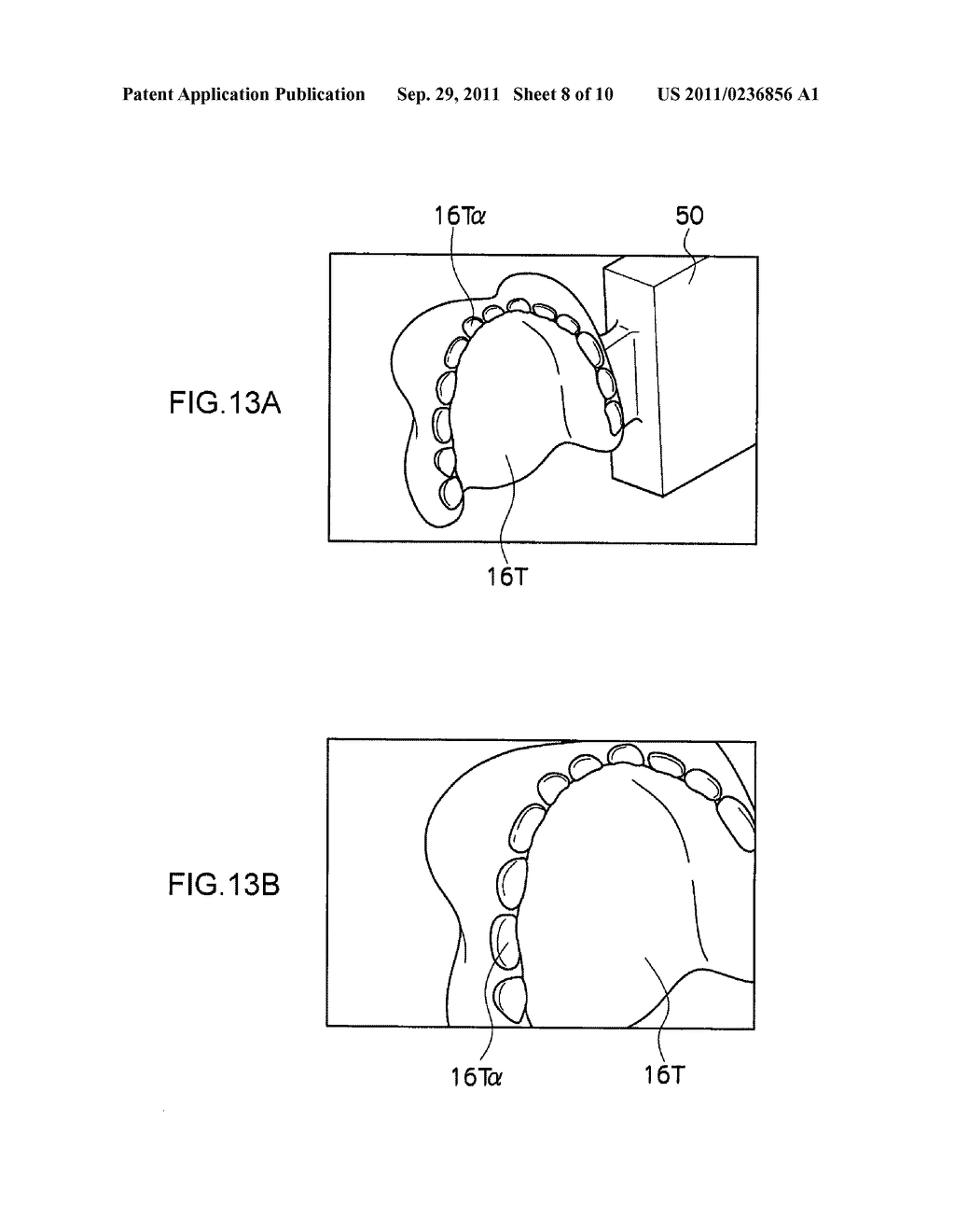 REMOVABLE DENTURE AND METHOD OF PRODUCING THE SAME - diagram, schematic, and image 09