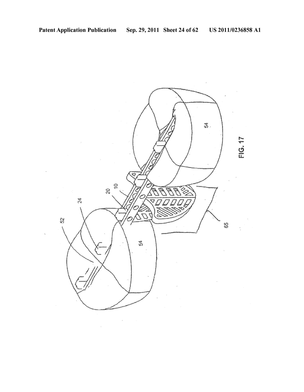 Dental device, such as bridge or insert - diagram, schematic, and image 25