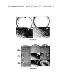 METHOD FOR FORMATION OF RENAL TUBULES diagram and image