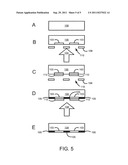 IMPLANT ALIGNMENT THROUGH A MASK diagram and image