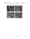 PLANT-DERIVED ELASTIN BINDING PROTEIN LIGANDS AND METHODS OF USING THE     SAME diagram and image