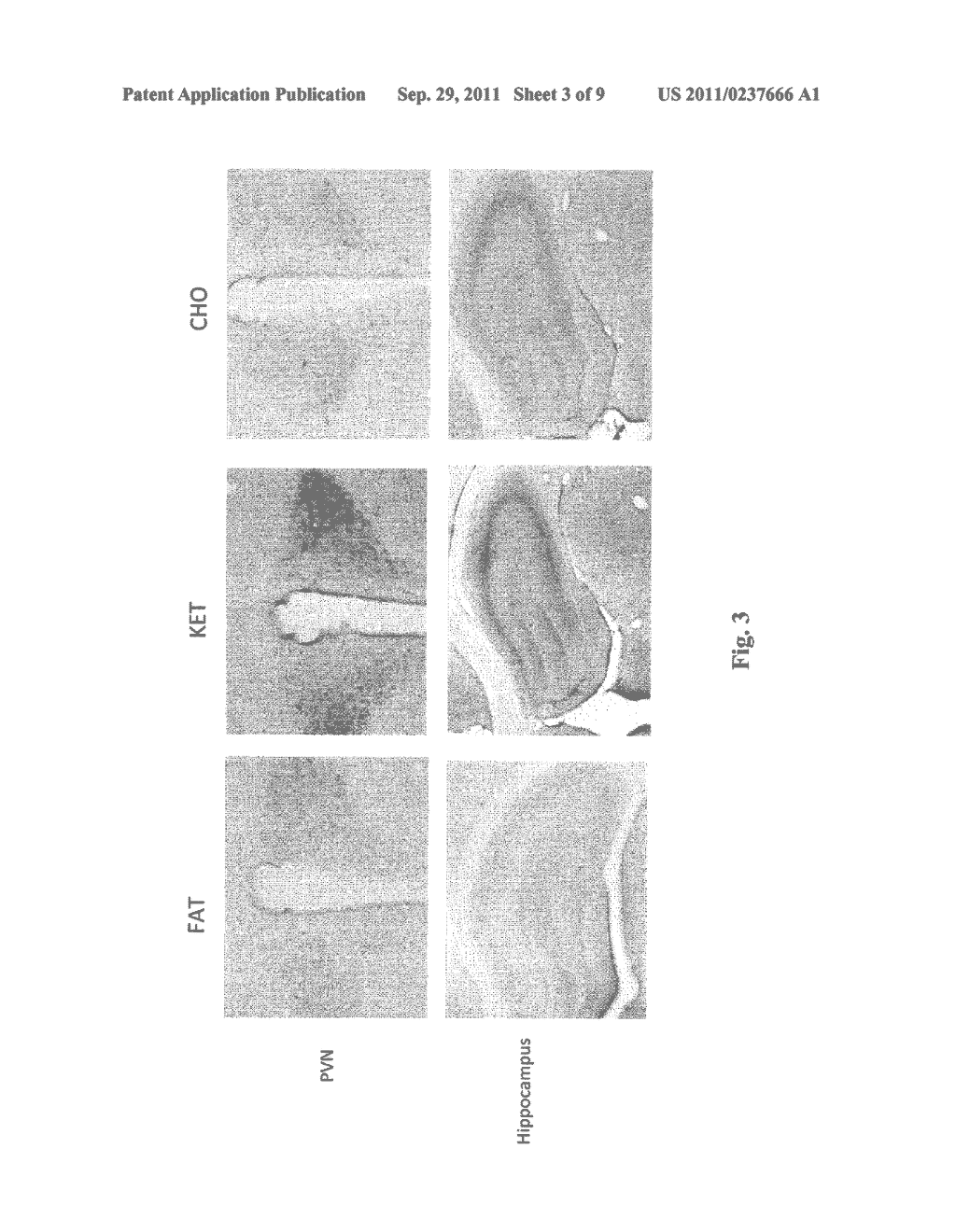 HYDROXYBUTYRATE ESTER AND MEDICAL USE THEREOF - diagram, schematic, and image 04