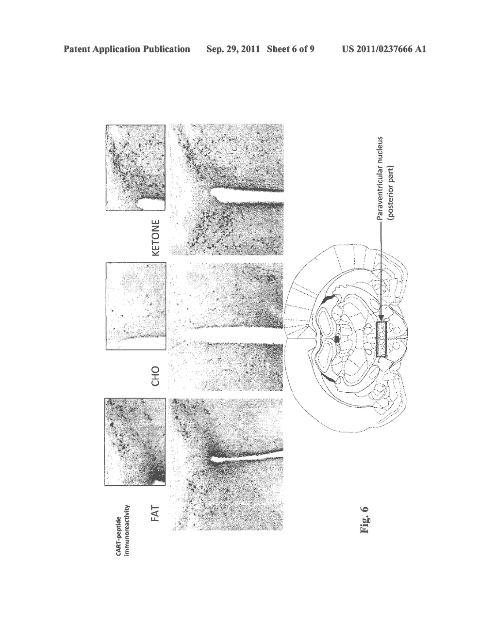 HYDROXYBUTYRATE ESTER AND MEDICAL USE THEREOF - diagram, schematic, and image 07