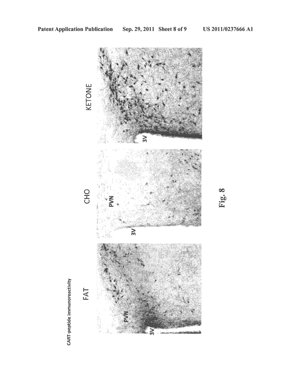 HYDROXYBUTYRATE ESTER AND MEDICAL USE THEREOF - diagram, schematic, and image 09