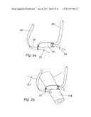 METHOD FOR SUPPORTING PELVIC ANATOMY diagram and image