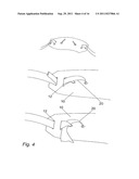 METHOD FOR SUPPORTING PELVIC ANATOMY diagram and image