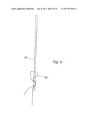 METHOD FOR SUPPORTING PELVIC ANATOMY diagram and image