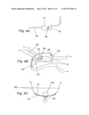 METHOD FOR SUPPORTING PELVIC ANATOMY diagram and image