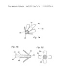 METHOD FOR SUPPORTING PELVIC ANATOMY diagram and image