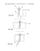 METHOD FOR SUPPORTING PELVIC ANATOMY diagram and image