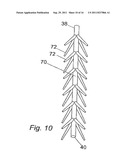 METHOD FOR SUPPORTING PELVIC ANATOMY diagram and image