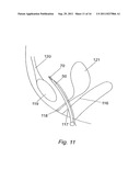 METHOD FOR SUPPORTING PELVIC ANATOMY diagram and image