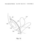 METHOD FOR SUPPORTING PELVIC ANATOMY diagram and image