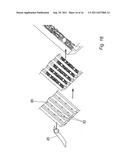 METHOD FOR SUPPORTING PELVIC ANATOMY diagram and image