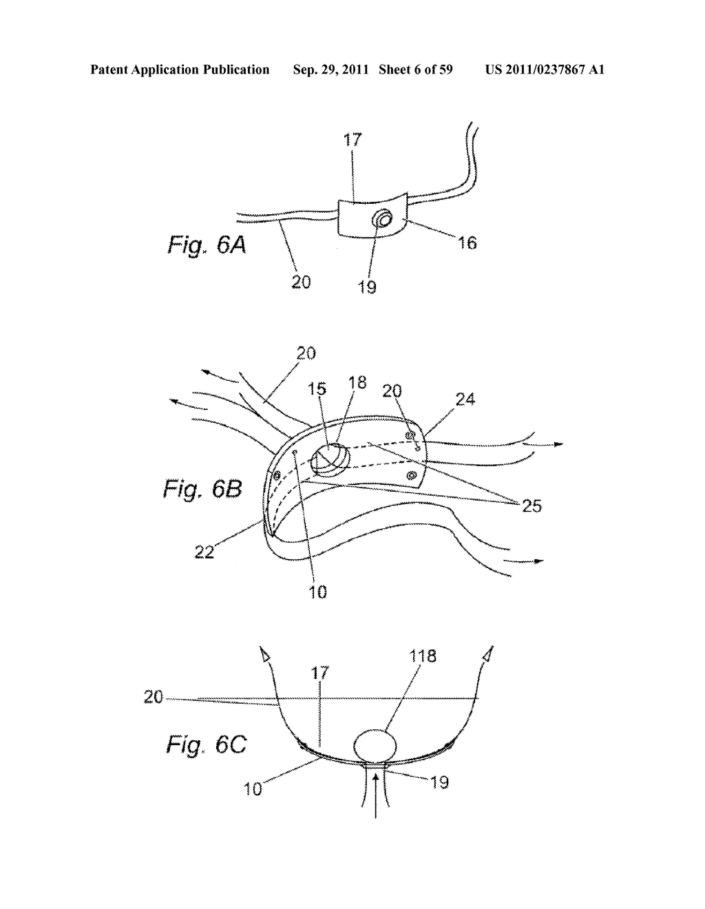 SYSTEM FOR INTRODUCING A PELVIC IMPLANT - diagram, schematic, and image 07