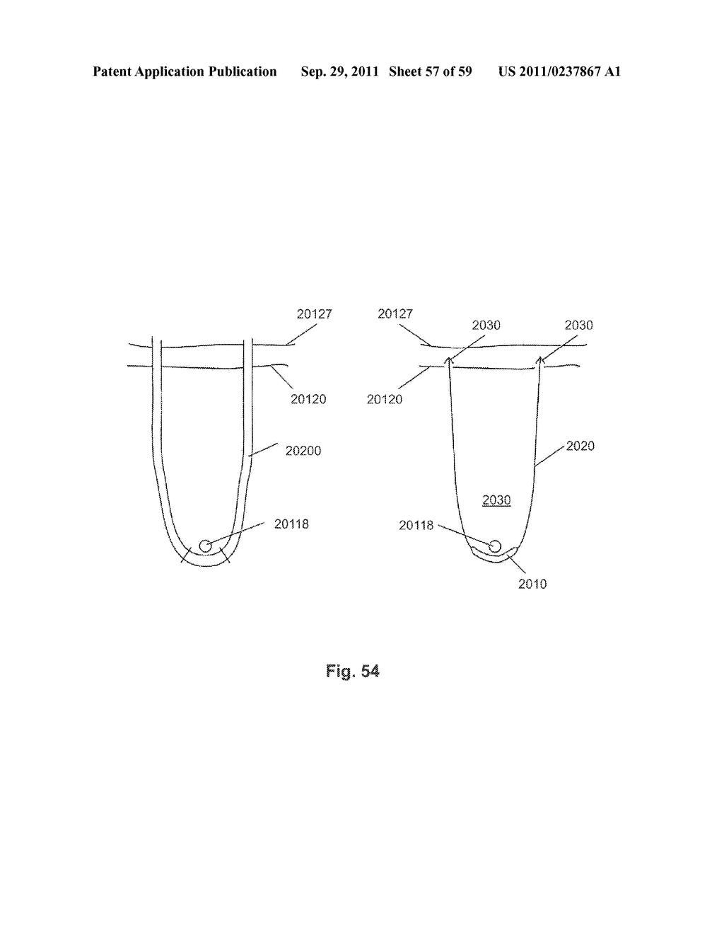 SYSTEM FOR INTRODUCING A PELVIC IMPLANT - diagram, schematic, and image 58