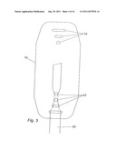 METHOD FOR IMPLANTING WITH AN ANCHOR INTRODUCER CHANNEL diagram and image