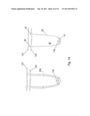 METHOD FOR IMPLANTING WITH AN ANCHOR INTRODUCER CHANNEL diagram and image