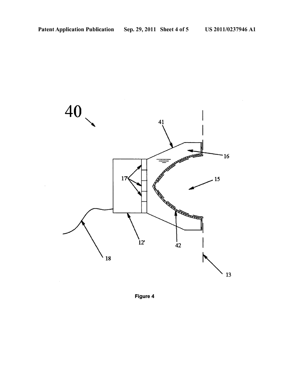 APPARATUS AND METHOD FOR THREE DIMENSIONAL ULTRASOUND BREAST IMAGING - diagram, schematic, and image 05