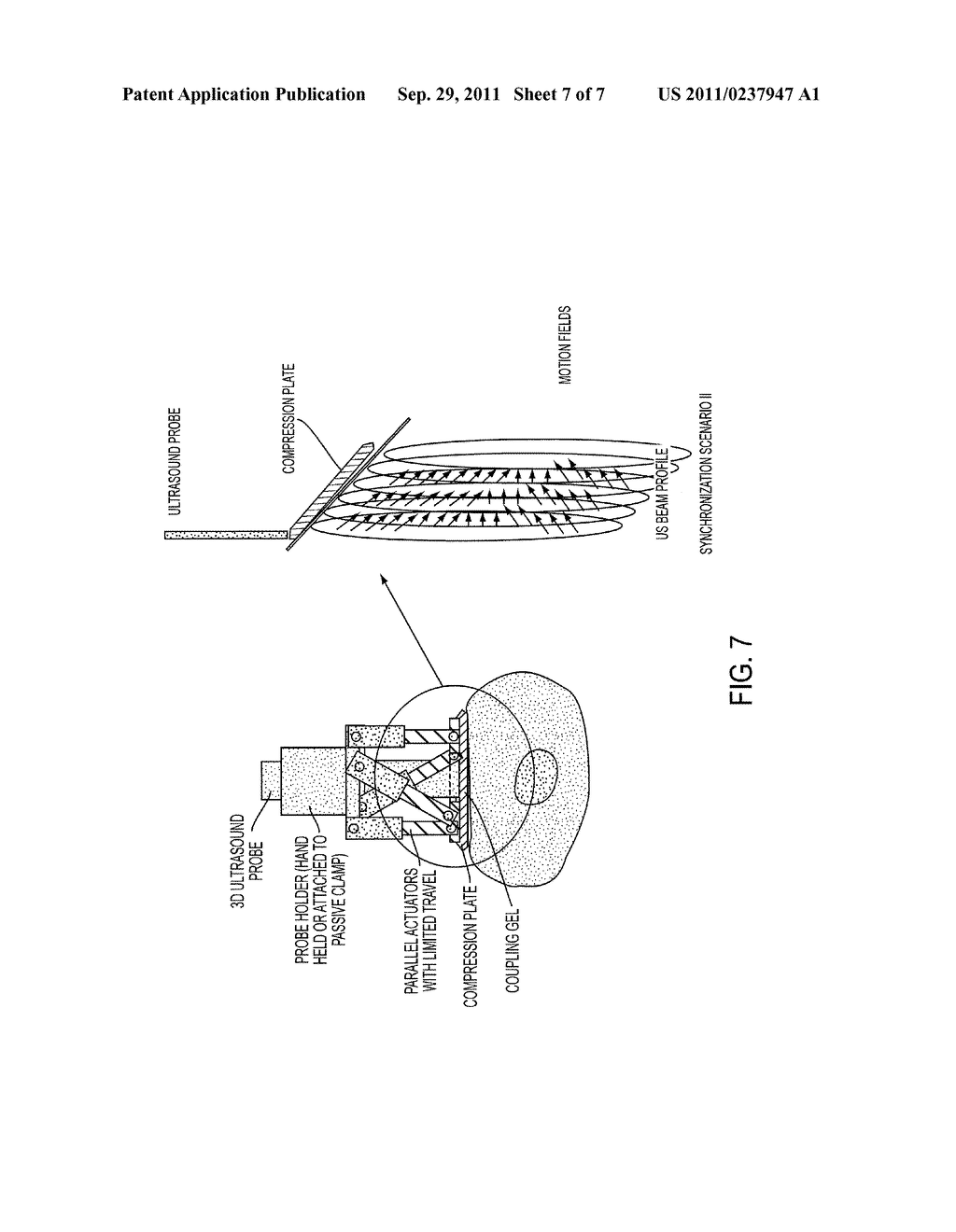 ROBOTIC 5-DIMENSIONAL ULTRASOUND - diagram, schematic, and image 08