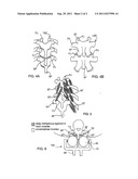 Massage Apparatus with Spherical Elements diagram and image