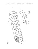 RESORBABLE INTRA-URETHRAL PROSTHESIS diagram and image