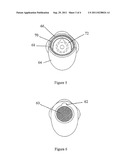 OSTOMY BAG diagram and image