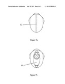 OSTOMY BAG diagram and image