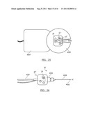 Method and Apparatus for Guiding an External Needle to an Implantable     Device diagram and image