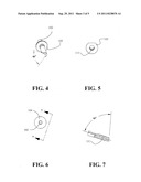 Orthopedic Downcutting Instrument and Associated Systems and Methods diagram and image