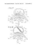 Minimally Invasive Surgical (MIS) Technique and System for Performing an     Interbody Lumbar Fusion with a Navigatable Intervertebral Disc Removal     Device and Collapsible Intervertebral Device diagram and image