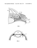 DRUG DELIVERY DEVICES AND METHODS diagram and image