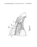 DRUG DELIVERY DEVICES AND METHODS diagram and image